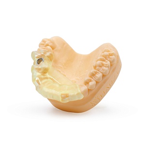 HARZ Labs Dental Yellow Clear PRO Resin